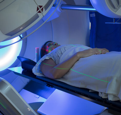 Y-90 RADIOEMBOLIZATION type of radiation Therapy